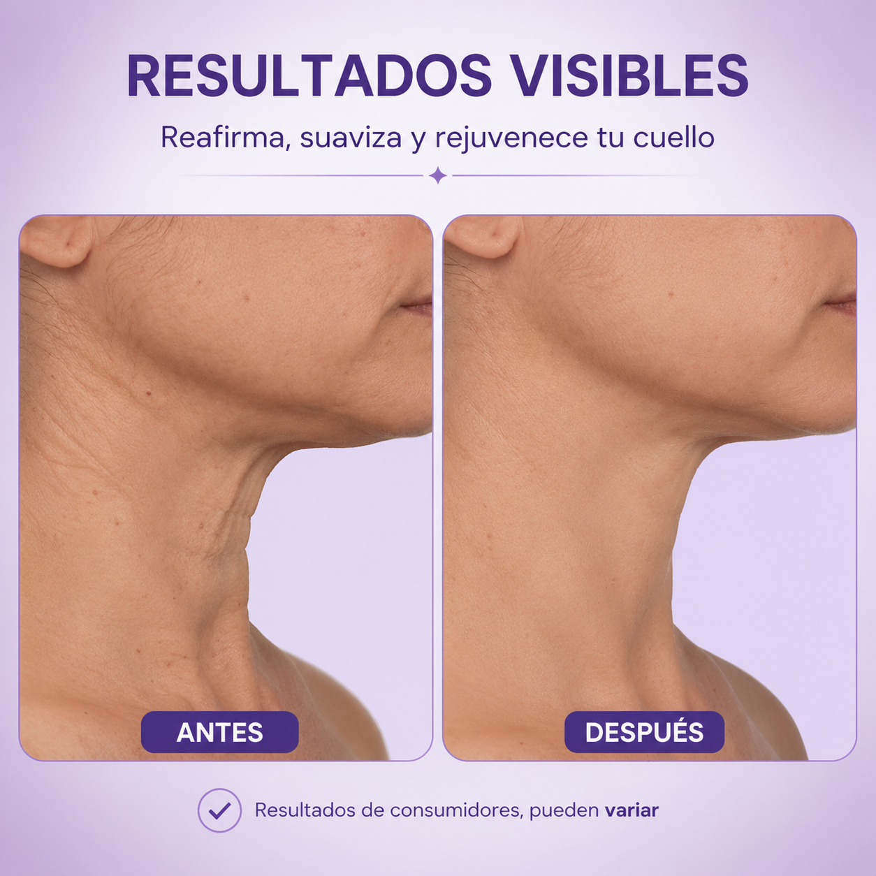 SOMNOVA | Reafirma y Renueva tu Cuello
