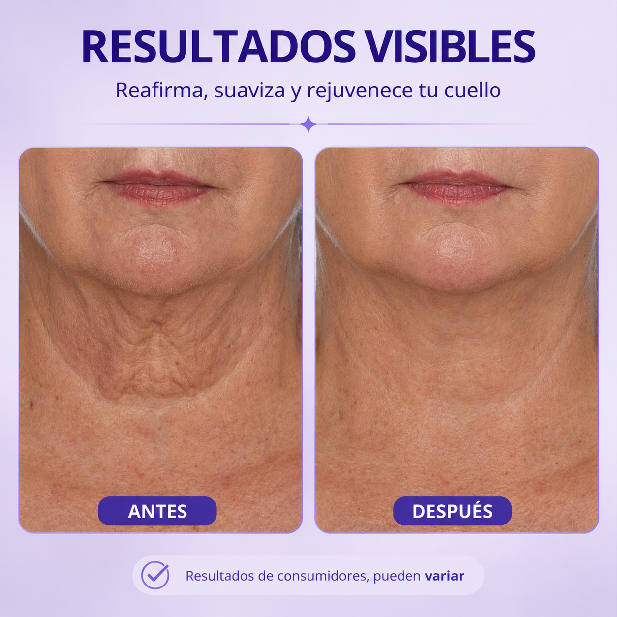 SOMNOVA | Reafirma y Renueva tu Cuello