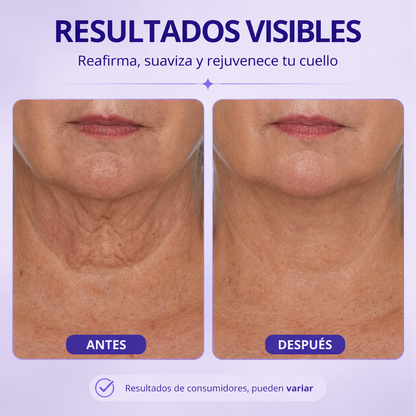 SOMNOVA | Reafirma y Renueva tu Cuello